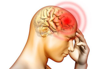Điều trị giảm mỡ máu có gây đột quỵ, giảm trí nhớ?