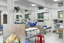 Hôn mê sâu vì hóc bánh rợm: Sơ cứu dị vật thế nào cho đúng?