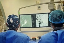 Ù tai, đỏ mắt không ngờ rò động mạch cảnh xoang hang sau tai nạn