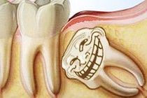 7 bộ phận cơ thể thừa thãi nhưng vẫn tồn tại