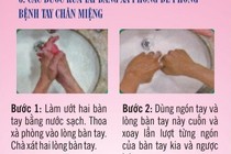 Hướng dẫn phòng bệnh tay chân miệng bằng hình ảnh