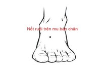 Nốt ruồi trên bàn chân nói lên điều gì? 