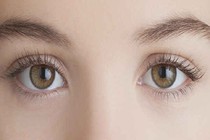 Sau khi phẫu thuật mắt có nên tiếp tục mổ cận thị?