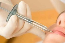Hỏng mặt, mắc u vì thẩm mỹ tiêm chất làm đầy