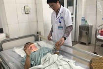 Phẫu thuật cứu sống bệnh nhân trật khớp cổ cao