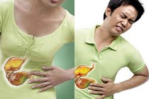 Có cách nào không cần nội soi vẫn tầm soát được ung thư dạ dày?