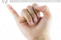 Ngón tay út co đau, mắt mở khó
