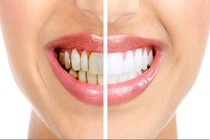15 tác dụng của tuyệt vời của giấm táo đối với sức khỏe có thể bạn chưa biết