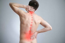 “Liệt chi” vì tiêm thuốc trị đau lưng