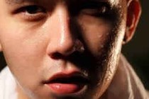 Cách điều trị bệnh ra nhiều mồ hôi