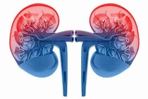 Nguy cơ chảy máu trong mổ khi thận xơ hóa