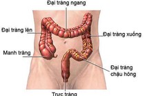 Nguy hiểm trẻ hóa ung thư đại trực tràng