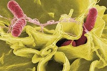 Biến chứng chết người do vi khuẩn Shigella