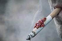Gần 97% bệnh nhân ung thư phổi có hút thuốc