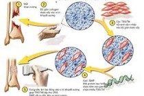 Liệu pháp tái sinh của tế bào gốc trung mô