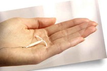 Tai biến vì quên tháo vòng tránh thai
