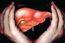 Cách chữa chảy máu tiêu hóa do xơ gan