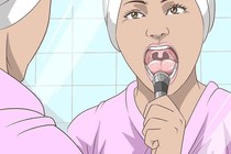 Họng bám đầy mảng trắng, cẩn thận viêm amidan có mủ “ghé thăm”