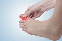 Đau ngón chân cái ảnh hưởng tới sinh dục, cột sống