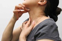 Chữa viêm amidan bằng Đông y