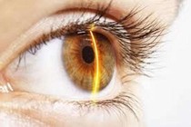 Hỏng mắt vì thuốc người lớn nhỏ cho trẻ 