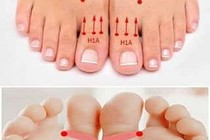 Xoa bấm ngón chân cái trị huyết áp cao