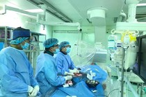 Khoan động mạch vành bị vôi hóa cứu bệnh nhân tắc động mạch vành
