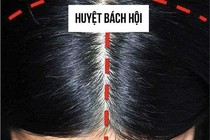 Day huyệt bách hội chữa huyết áp thấp, rối loạn tiền đình