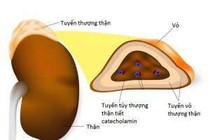 U tủy thượng thận và viêm cơ tim