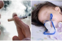 Bố hút thuốc lá con viêm phế quản bội nhiễm 