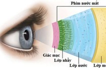 Khô mắt chớ coi thường