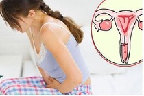 Kinh nguyệt kéo dài – Dấu hiệu bệnh u xơ tử cung bạn không nên bỏ qua!