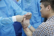 Ghép chi thể từ hai ca tai nạn lao động 