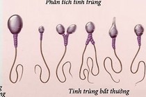 Xông hơi làm yếu "tinh binh"