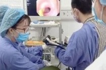 Xương cá 6cm đâm tá tràng