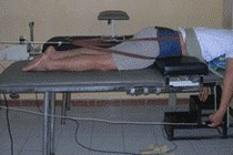 Phương pháp mới điều trị thoát vị đĩa đệm 