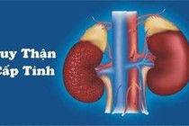 Bị bệnh suy thận cấp có phục hồi được không?