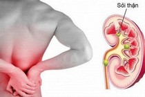 Bị đau lưng đi tiểu buốt 