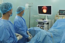 Tán vỡ sỏi to trong bàng quang tân tạo bằng laser