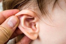 Viêm tai giữa lâu ngày nên tầm soát lao tai 