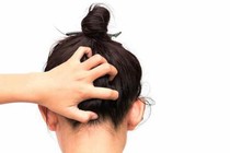 Đi học bán trú bị lây chấy