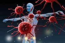 Cây thuốc Nam giúp tăng miễn dịch và làm sạch virus gây viêm gan khỏi cơ thể