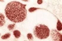 Nhiễm vi khuẩn ureaplasma urealyticum và vô sinh nam