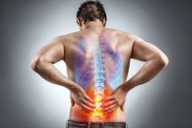Thoát vị đĩa đệm thể trung tâm