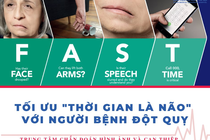  Lệch mặt do đột quỵ lại tưởng liệt dây thần kinh