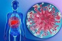 Xét nghiệm định lượng virus viêm gan B