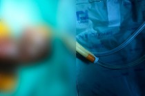 Cấp cứu trường hợp gãy dương vật sau té ngã!