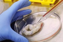 Tế bào gốc điều trị bệnh phổi tắc nghẽn mạn tính