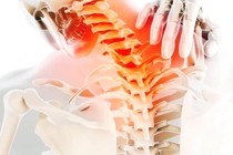 Tự chăm sóc khi bị đau cổ vai gáy