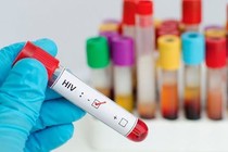Nâng cao nhận thức về dự phòng lây nhiễm HIV 